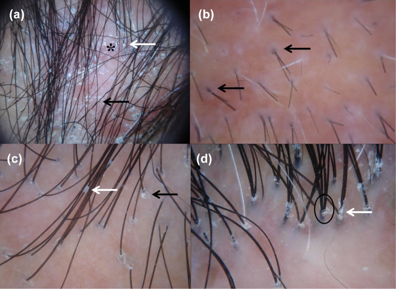 Fig. 1