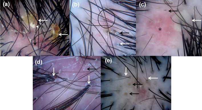 Fig. 2