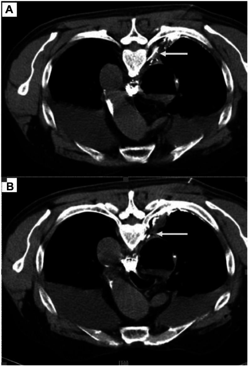 Fig 2: