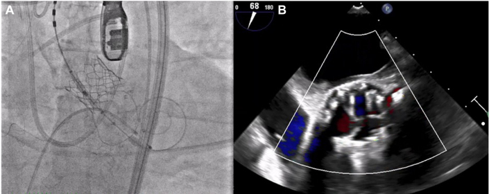 Figure 3