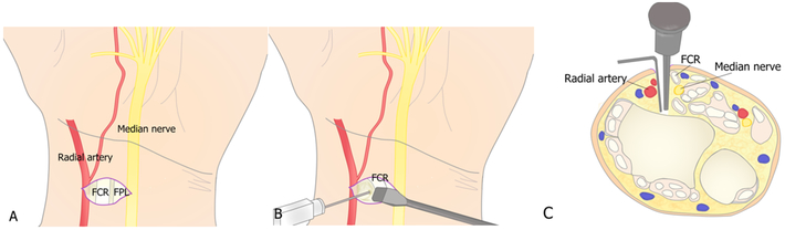 Figure 17.