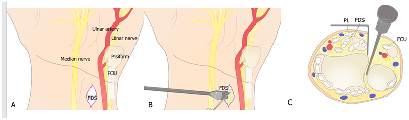 Figure 18.