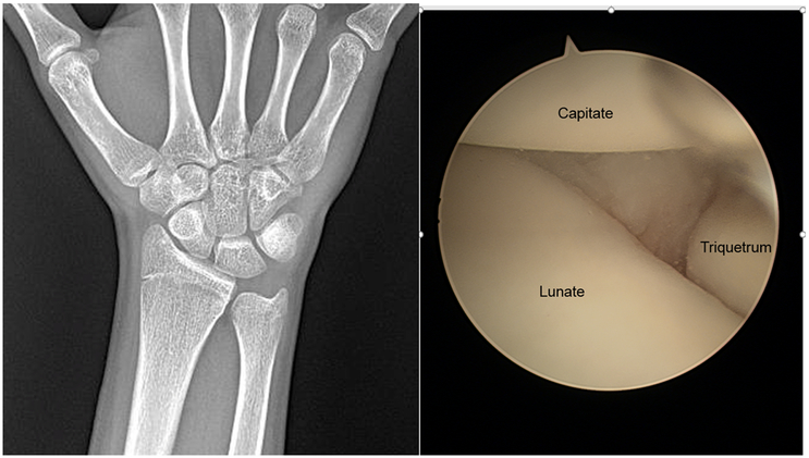 Figure 14.