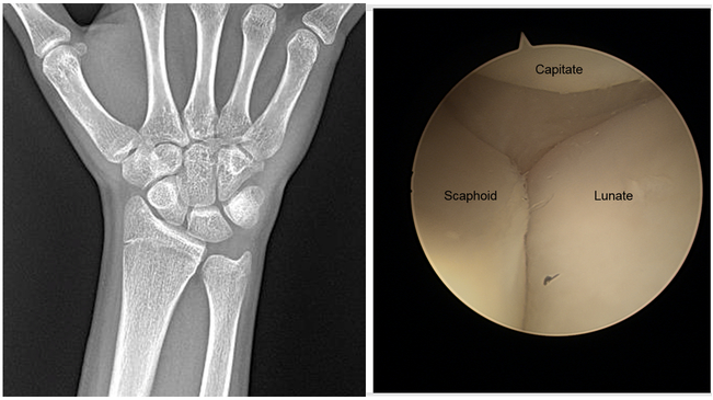 Figure 11.