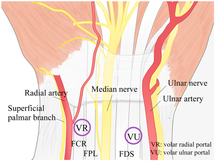 Figure 16.