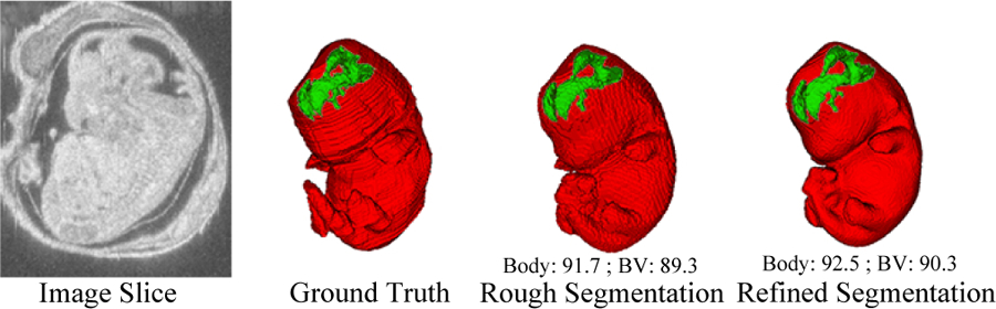 Fig. 1: