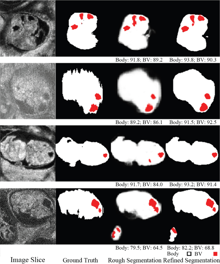 Fig. 4: