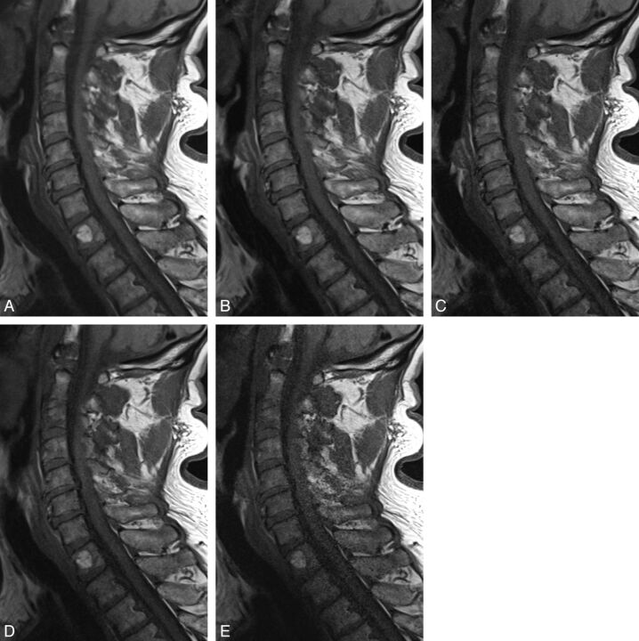 Fig 4.