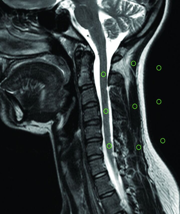 Fig 2.