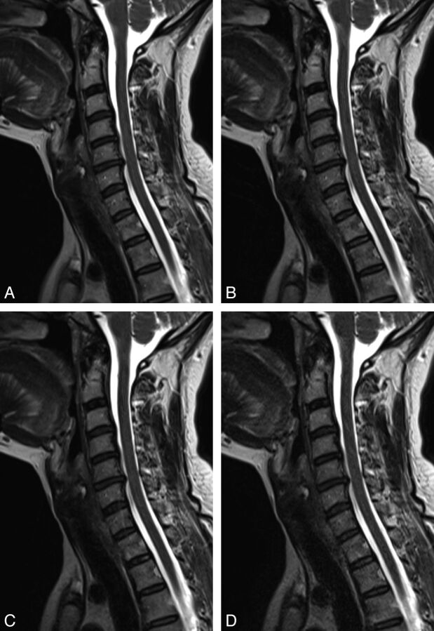 Fig 5.