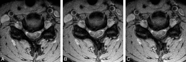 Fig 6.