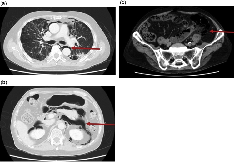 Fig. 2