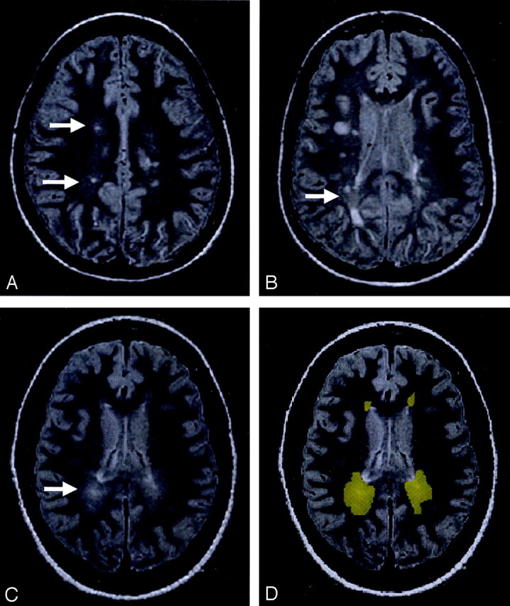 Fig 1.