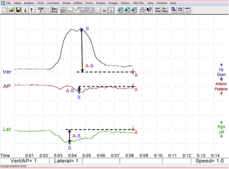 Fig. 3