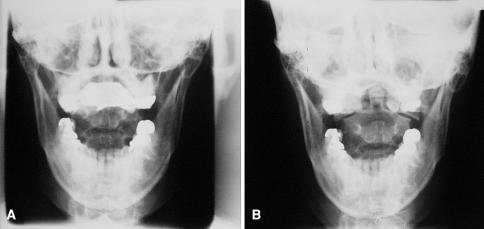 Fig. 1A–B