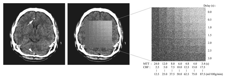 Figure 1b: