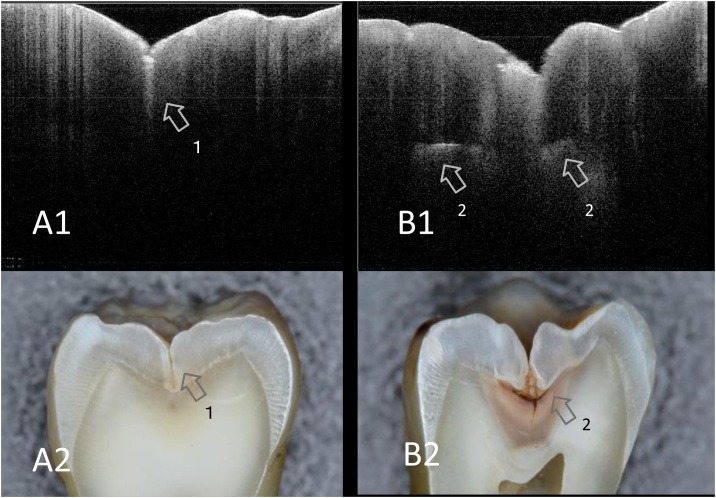 Fig. 5