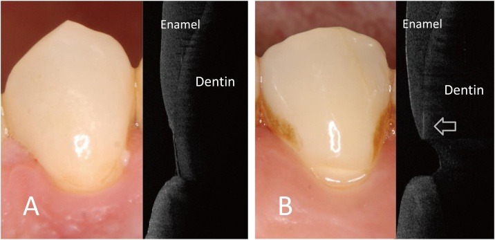 Fig. 9