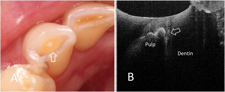 Fig. 11