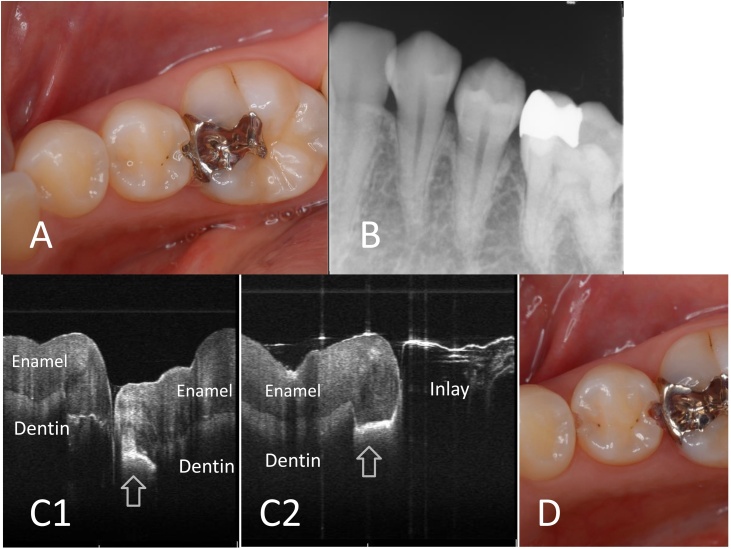 Fig. 6