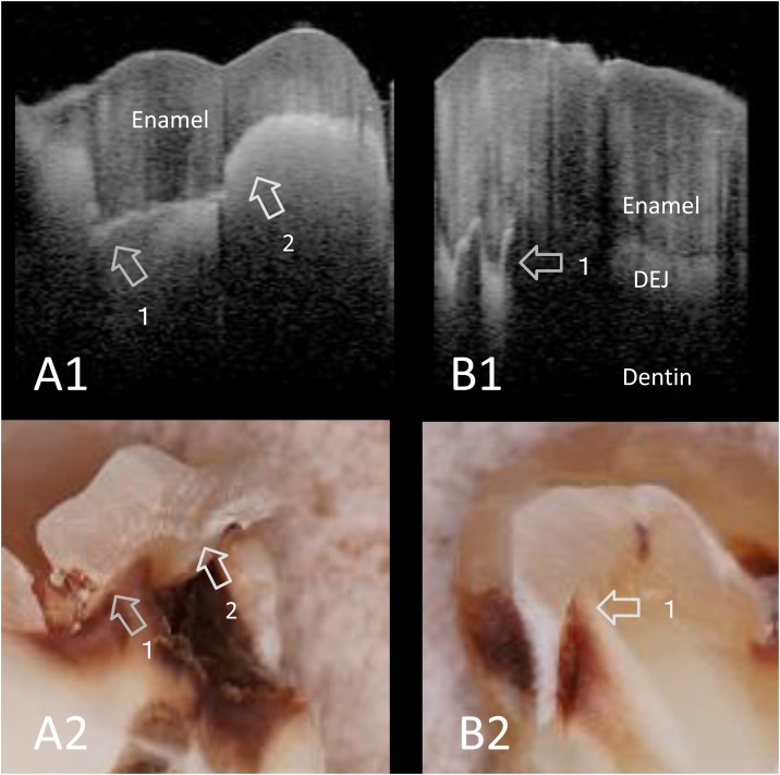 Fig. 4