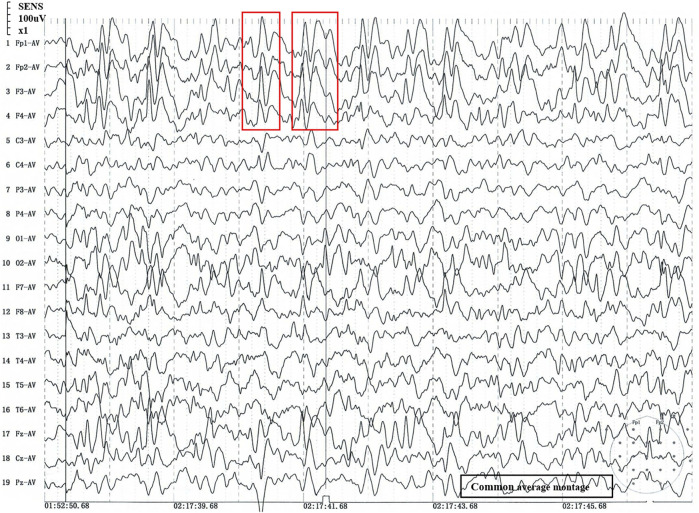 FIGURE 1