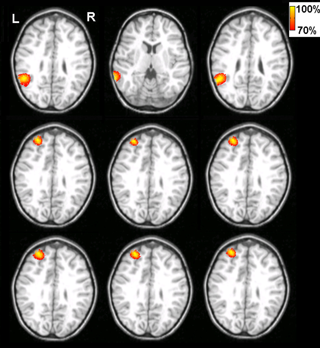 Fig. 10