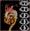 Fig 4