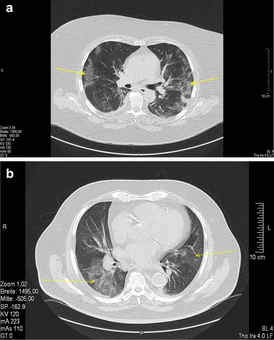 Fig. 1