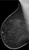 Figure 2c: