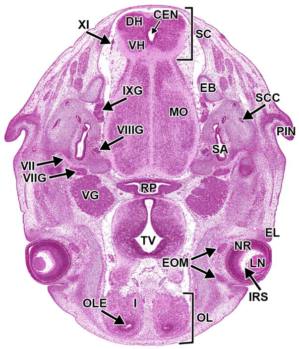 Figure 22