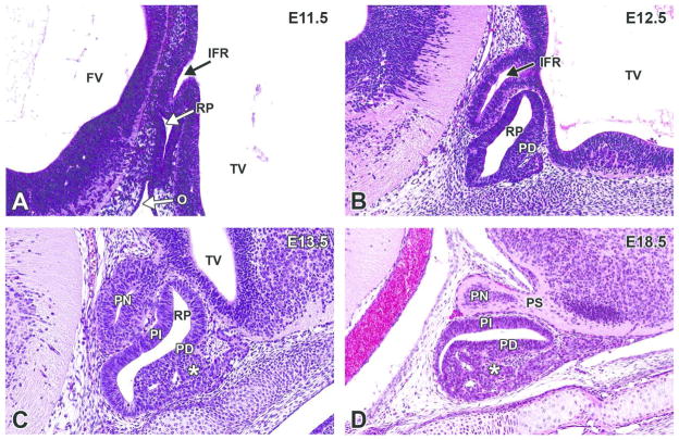 Figure 13