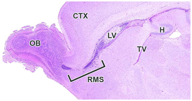 Figure 26