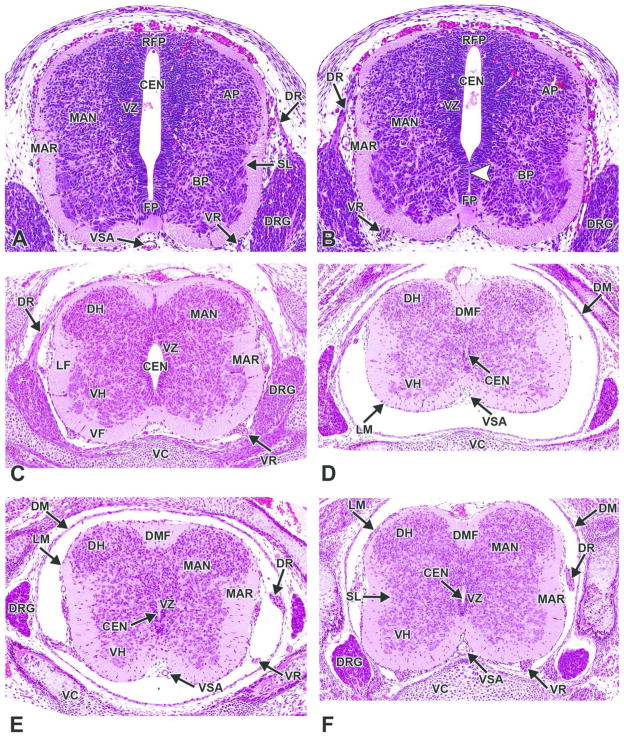 Figure 17