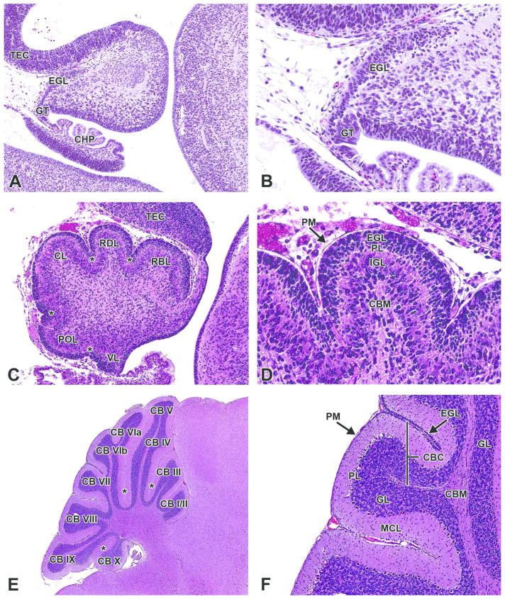 Figure 21