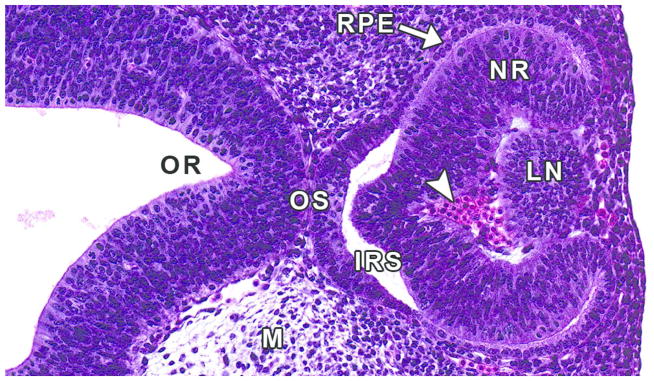 Figure 12