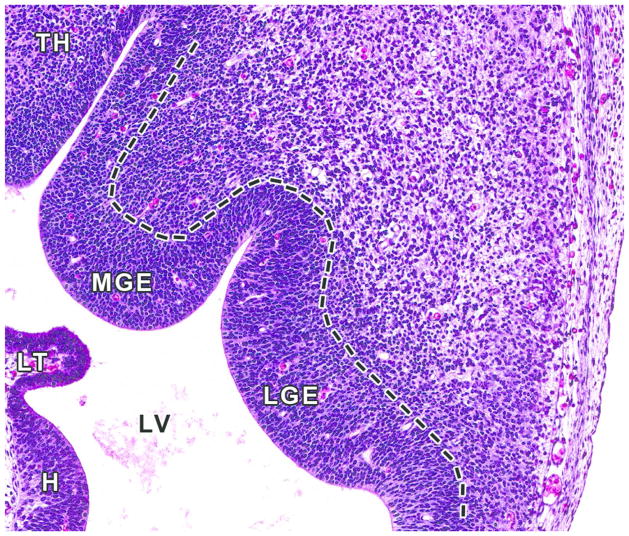 Figure 11