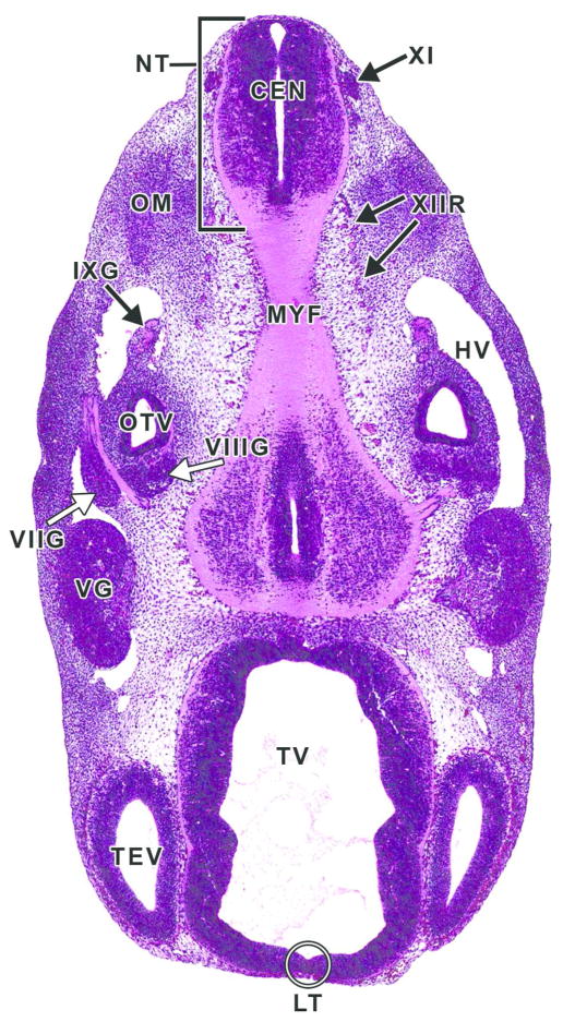 Figure 14