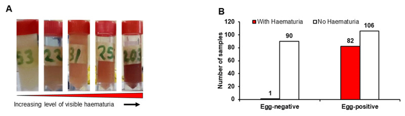 Urine in tubes showing haematuria and bar chart for haematuria