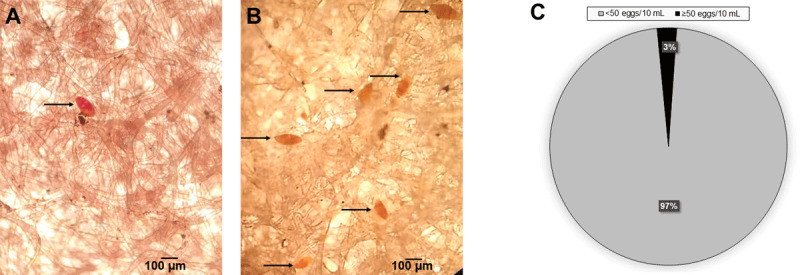 Microscopic identification of S. haematobium eggs