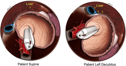 Fig. 3