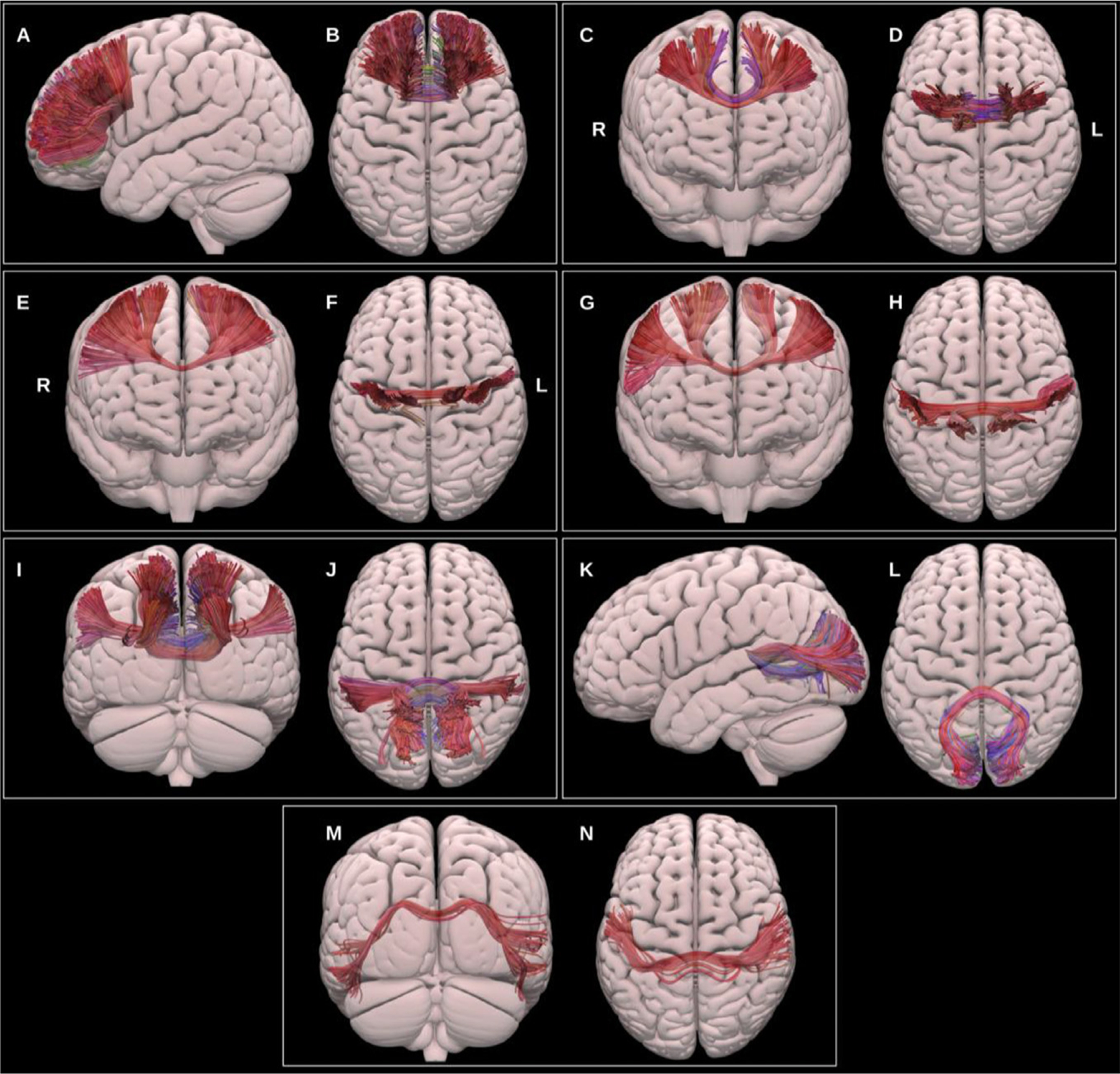 Fig. 14.