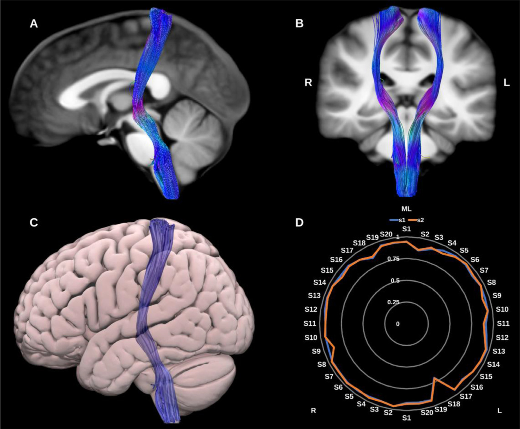 Fig. 15.