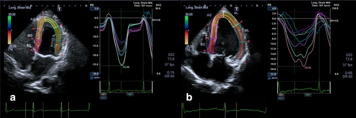 Fig. 3