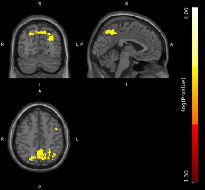 Figure 11