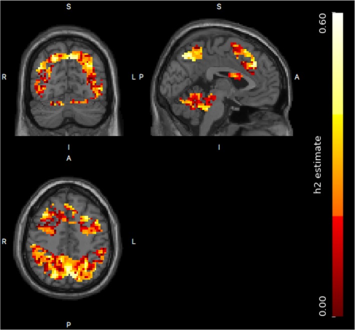 Figure 12