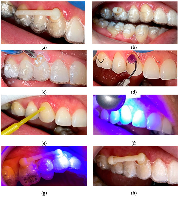 Figure 15