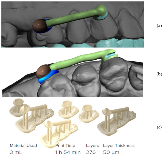 Figure 12