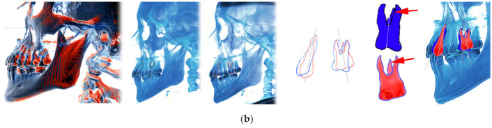 Figure 18