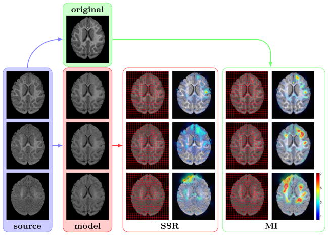 Fig. 16